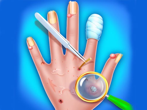 Hand Skin Doctor  Hospital Game